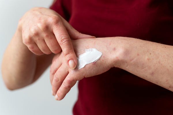 How To Apply Dovobet Gel?