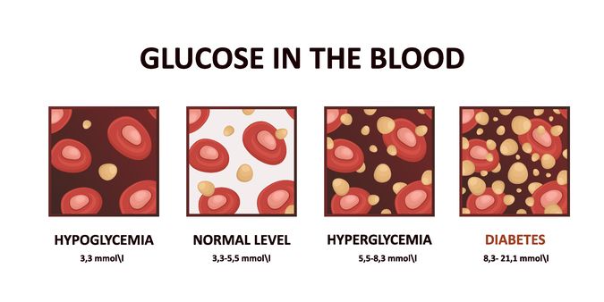 Blood glucose levels from low to high blood sugar