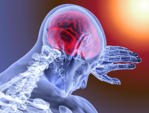 Migraines can make you more sensitive to light.